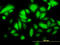 Keratin 17 antibody, LS-B6108, Lifespan Biosciences, Immunofluorescence image 