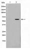 MAP kinase-activated protein kinase 5 antibody, TA348440, Origene, Western Blot image 