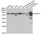 Aldehyde Dehydrogenase 4 Family Member A1 antibody, MBS129152, MyBioSource, Western Blot image 