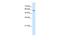 Chaperonin Containing TCP1 Subunit 8 antibody, NBP1-56608, Novus Biologicals, Western Blot image 