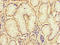 Nuclear Receptor Interacting Protein 3 antibody, LS-C379494, Lifespan Biosciences, Immunohistochemistry paraffin image 