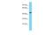 Tsukushi, Small Leucine Rich Proteoglycan antibody, A13036, Boster Biological Technology, Western Blot image 