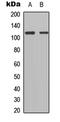 Teashirt Zinc Finger Homeobox 1 antibody, LS-C358375, Lifespan Biosciences, Western Blot image 