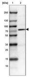 Protein Arginine Methyltransferase 2 antibody, NBP1-83207, Novus Biologicals, Western Blot image 