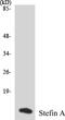 Cystatin A antibody, EKC1548, Boster Biological Technology, Western Blot image 