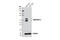 MAPK Activated Protein Kinase 2 antibody, 12155S, Cell Signaling Technology, Western Blot image 