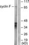 Cyclin F antibody, TA313570, Origene, Western Blot image 