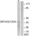 Olfactory Receptor Family 13 Subfamily C Member 2 antibody, A17534, Boster Biological Technology, Western Blot image 