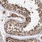 Inositol Polyphosphate-4-Phosphatase Type II B antibody, PA5-58056, Invitrogen Antibodies, Immunohistochemistry paraffin image 