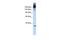 Pre-mRNA-processing-splicing factor 8 antibody, PA5-41817, Invitrogen Antibodies, Western Blot image 