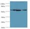 Atlastin GTPase 3 antibody, A50981-100, Epigentek, Western Blot image 