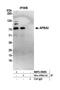 Amyloid Beta Precursor Protein Binding Family A Member 3 antibody, NBP2-59085, Novus Biologicals, Western Blot image 