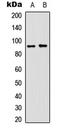 Neural Cell Adhesion Molecule 1 antibody, LS-C368660, Lifespan Biosciences, Western Blot image 