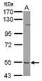 6-Phosphofructo-2-Kinase/Fructose-2,6-Biphosphatase 3 antibody, PA5-32013, Invitrogen Antibodies, Western Blot image 
