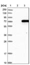 T Cell Receptor Beta Variable 7-9 antibody, NBP1-88208, Novus Biologicals, Western Blot image 