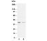 CD82 Molecule antibody, R30364, NSJ Bioreagents, Western Blot image 