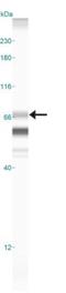Preferentially Expressed Antigen In Melanoma antibody, NBP2-23670, Novus Biologicals, Western Blot image 