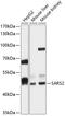 Seryl-TRNA Synthetase 2, Mitochondrial antibody, 14-350, ProSci, Western Blot image 