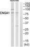 cGMP-gated cation channel alpha-1 antibody, abx014349, Abbexa, Western Blot image 