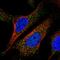 POP7 Homolog, Ribonuclease P/MRP Subunit antibody, PA5-54305, Invitrogen Antibodies, Immunofluorescence image 