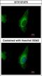 Oxysterol Binding Protein Like 8 antibody, GTX121273, GeneTex, Immunocytochemistry image 
