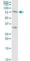 Protein Kinase C Eta antibody, H00005583-D01P, Novus Biologicals, Western Blot image 