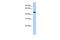 KIAA0825 antibody, GTX45226, GeneTex, Western Blot image 