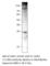 ATP Binding Cassette Subfamily C Member 8 antibody, SUR1-101AP, FabGennix, Western Blot image 