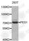 Pescadillo Ribosomal Biogenesis Factor 1 antibody, A5973, ABclonal Technology, Western Blot image 