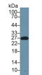 Amyloid P Component, Serum antibody, LS-C296395, Lifespan Biosciences, Western Blot image 