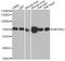 Anthrax toxin receptor 2 antibody, A6526, ABclonal Technology, Western Blot image 