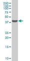 SWI/SNF Related, Matrix Associated, Actin Dependent Regulator Of Chromatin, Subfamily B, Member 1 antibody, H00006598-M02, Novus Biologicals, Western Blot image 