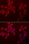 Chondromodulin antibody, STJ28727, St John