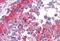 Catechol-O-Methyltransferase antibody, NB100-41387, Novus Biologicals, Immunohistochemistry paraffin image 