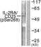 CD25 antibody, LS-C199111, Lifespan Biosciences, Western Blot image 