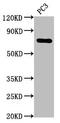 Tumor Protein P63 antibody, CSB-RA887971A0HU, Cusabio, Western Blot image 