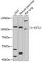 Exostosin Like Glycosyltransferase 3 antibody, GTX64791, GeneTex, Western Blot image 