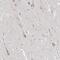 Asparagine Synthetase (Glutamine-Hydrolyzing) antibody, PA5-56113, Invitrogen Antibodies, Immunohistochemistry paraffin image 