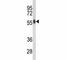 AKT Serine/Threonine Kinase 2 antibody, F50044-0.4ML, NSJ Bioreagents, Western Blot image 