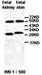 N-Acetyltransferase 2 antibody, orb77320, Biorbyt, Western Blot image 