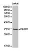 Caspase 6 antibody, TA327177, Origene, Western Blot image 