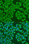 Insulin Like Growth Factor 2 MRNA Binding Protein 3 antibody, 22-006, ProSci, Immunofluorescence image 