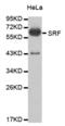 Serum Response Factor antibody, abx000712, Abbexa, Western Blot image 