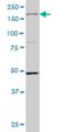 Mitogen-Activated Protein Kinase Kinase Kinase 4 antibody, H00004216-M05, Novus Biologicals, Western Blot image 