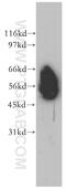CD46 Molecule antibody, 12494-1-AP, Proteintech Group, Western Blot image 