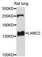 Laminin Subunit Gamma 2 antibody, abx126075, Abbexa, Western Blot image 