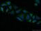 Protein Phosphatase 3 Catalytic Subunit Alpha antibody, 13422-1-AP, Proteintech Group, Immunofluorescence image 
