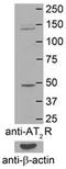 Angiotensin II Receptor Type 2 antibody, TA342805, Origene, Western Blot image 