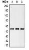 Keratin 8 antibody, MBS821307, MyBioSource, Western Blot image 