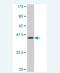 Crystallin Gamma C antibody, H00001420-M01C, Novus Biologicals, Western Blot image 